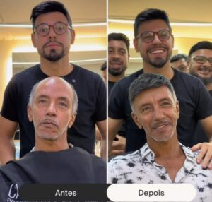 antes-e-depois-de-um-implante-capilar--davidX (2)